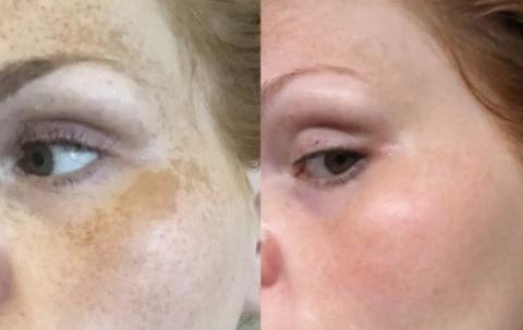 Mabox Vitamin C Serum/Retinol Moisturizer Face Cream