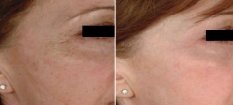Mabox Vitamin C Serum/Retinol Moisturizer Face Cream