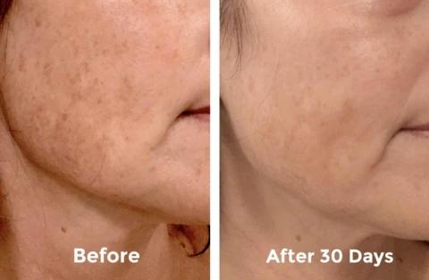 Mabox Vitamin C Serum/Retinol Moisturizer Face Cream