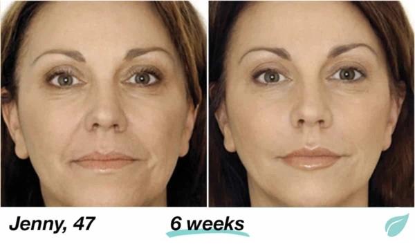 Mabox Vitamin C Serum/Retinol Moisturizer Face Cream